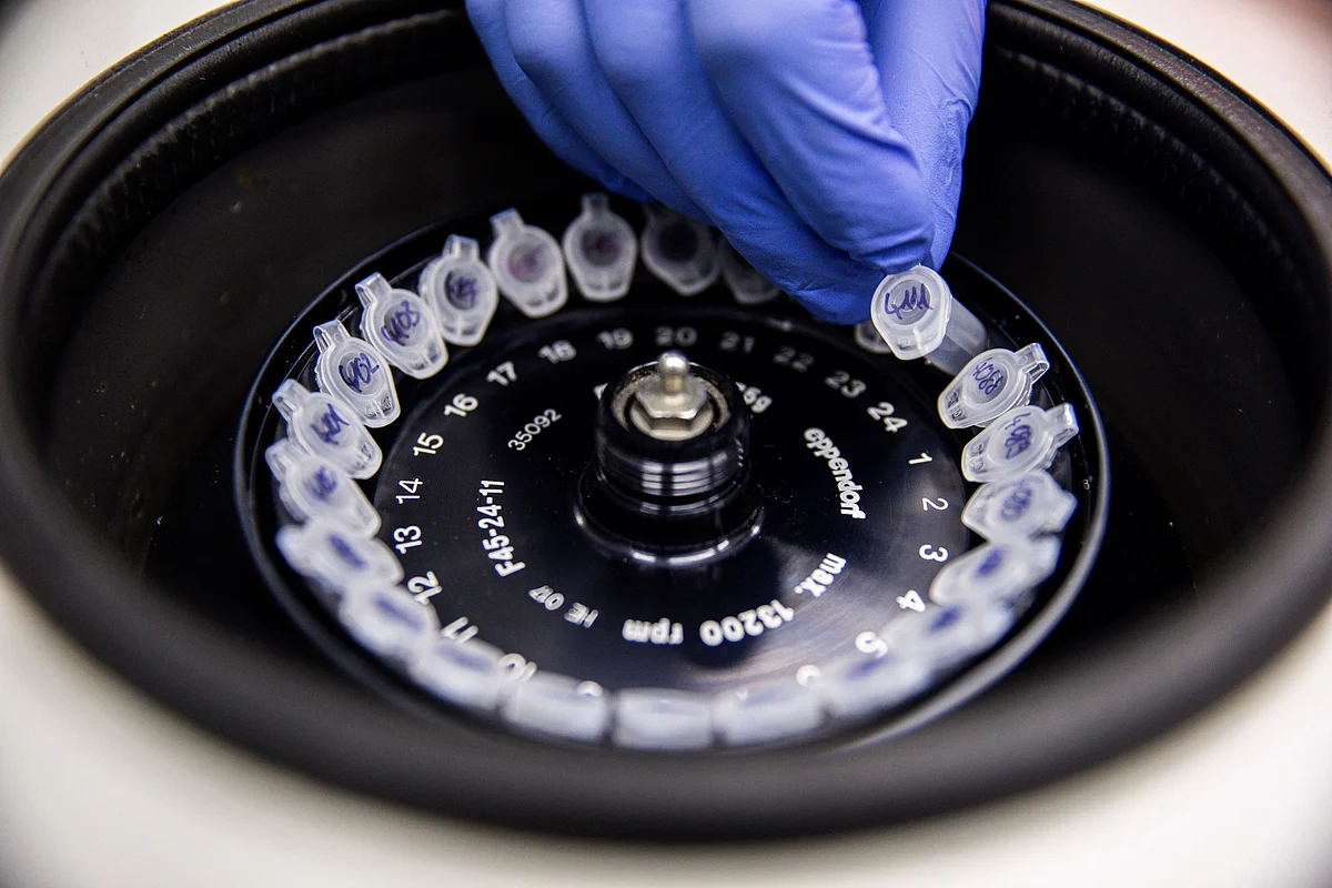 Krsnaa Diagnostics IPO - Premium Valuation For Differentiated Diagnostics: Dolat Capital 1 Krsnaa Diagnostics IPO - Premium Valuation For Differentiated Diagnostics: Dolat Capital
