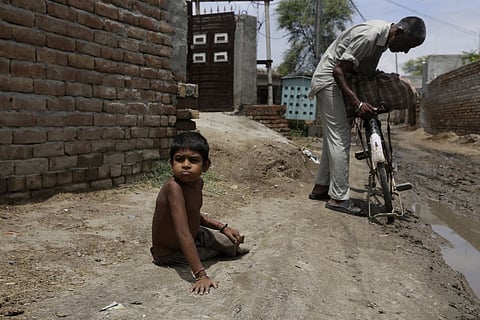 Acute malnutrition worsened among children: NFHS-5