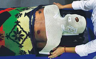 A cancer patient
gets ready for
radiotherapy
at the North
Bengal
Oncology
Center near
Siliguri (Photo: Reuters)