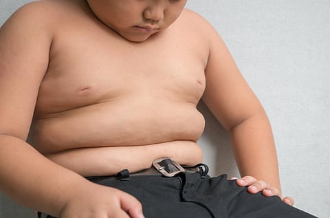 A study shows that obesity is related to household income (Credit: iStock images)