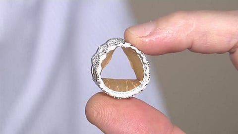 85 फीसदी तक घटे कार्डिएक स्टेंट के दाम, मरीजों को राहत