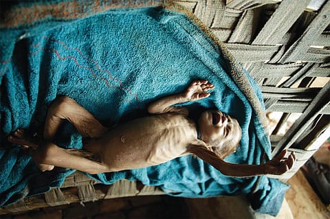 नाम:बेबी,
उम्र: ११ महीने,
वजन:3.4 किलो