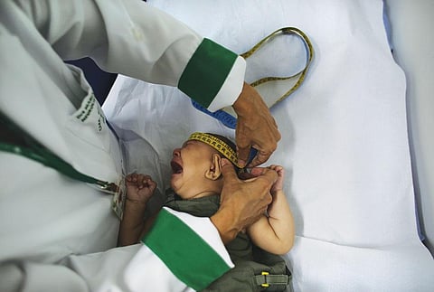 जीका वायरस गर्भ में पलने वाले बच्चे पर असर डालता है। पीड़ित बच्चों के सिर का आकार स्वस्थ बच्चों की तुलना मे छोटा होता है (रॉयटर्स )