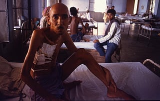 India continues to have the highest number of TB cases in the world. Credit: Pradip Saha / CSE