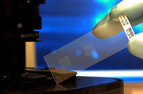The device uses a biochip and a nanomaterial based on Zinc Oxide. Credit: Wikimedia Commons