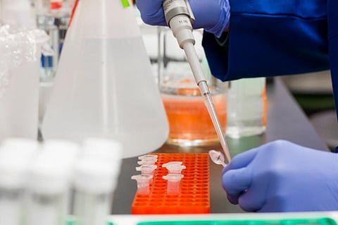 Researchers have identified a yeast strain called Saccharomyces cerevisiae. Credit: Pexels