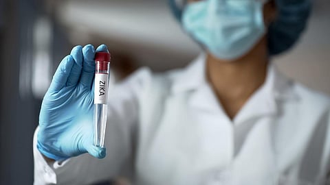 India can establish that the increase in microcephaly is linked to Zika virus if we regularly monitor the cases of fever and check babies for presence of the virus. Credit: Getty Images