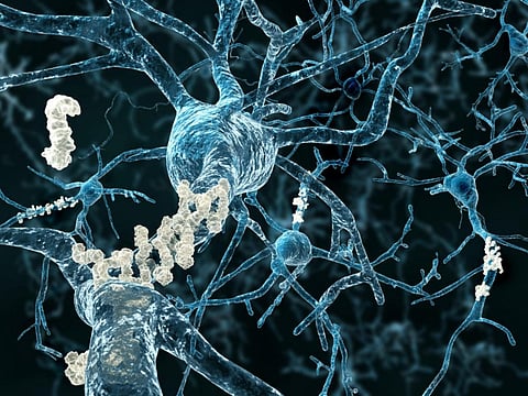 Alzheimer protein can be transmitted, says the study