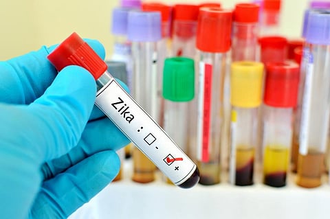 Anti-malaria drug may be repurposed to treat Zika