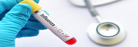 A 2015-like swine flu outbreak might be on the anvil