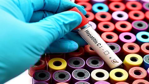 How liver protein can aid in developing vaccine for hepatitis C