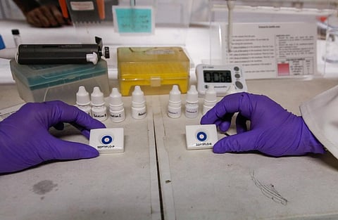 COVID-19: Sharp dip in TB cases during lockdown, timely diagnosis major worry