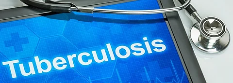 HIV-associated tuberculosis on the rise: India TB Report
