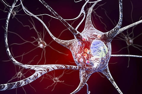 Scientists find how a gene causes Parkinson’s, Crohn’s and leprosy