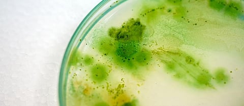 Gene that can boost photosynthesis identified in cyanobacteria