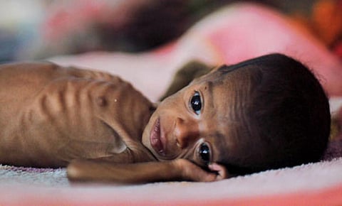 आजादी के 72 साल बाद आज भी भारत में 94 फीसदी नौनिहालों को नहीं मिलता पोषक आहार, जबकि विडम्बना देखिये 58 फीसदी आज भी भरपेट नहीं सोते