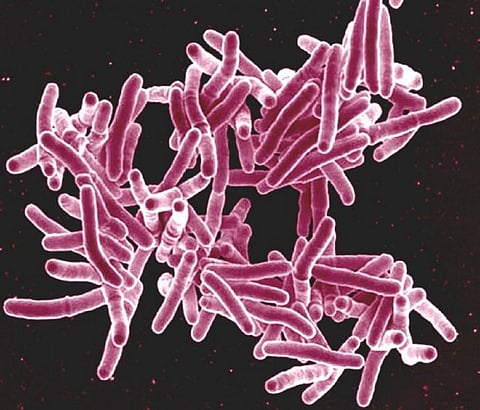 Scientists find a new way to fight TB