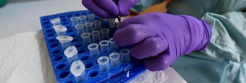 Lassa fever: Why there’s a call to declare a health emergency in Nigeria