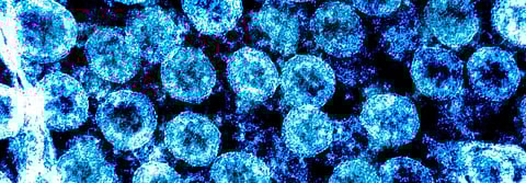 Coronavirus update: India becomes first country to suspend visas of all foreign nationals