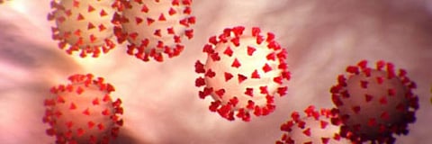 Is COVID-19 containable