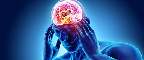 Cluster headache is more than ‘just a headache’ — but is often misdiagnosed