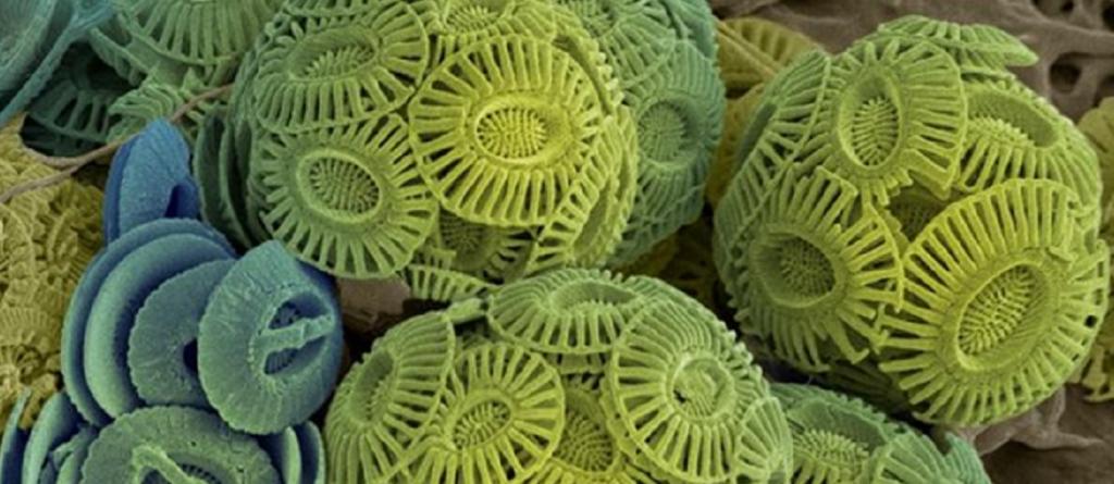 Transmission Electron Microscope (TEM) image of Coccolithopores. Photo: India Science Wire