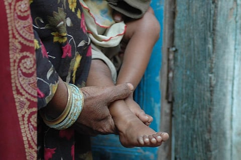 कोविड-19 महामारी का पोलियो उन्मूलन सहित सार्वजनिक स्वास्थ्य कार्यक्रमों पर बड़ा प्रभाव पड़ा है। फोटो सीएसई