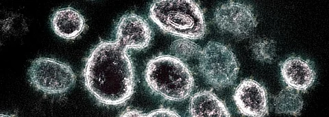 Coronavirus update: India adds more than 47,000 cases