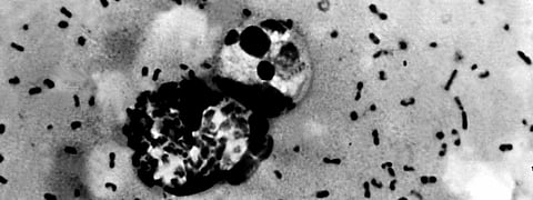 Plague — though limited in geography — continues to be a dreaded infection. Photo: Pixnio
