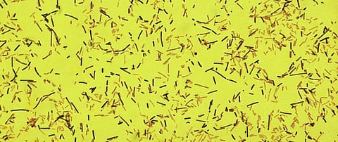 Biodiversity loss could be making us sick – here’s why