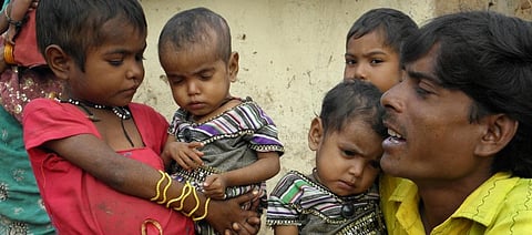 ‘Passionate strategy needed to mitigate malnutrition due to lockdown’