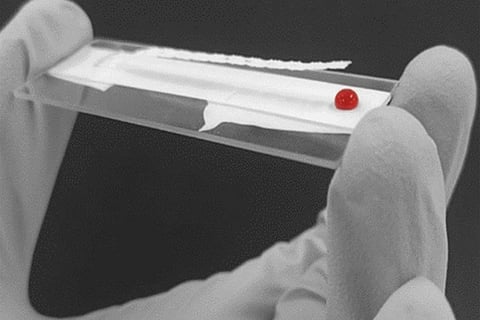 हर साल 20 लाख से अधिक होने वाली मौतों को रोक सकती यह जांच