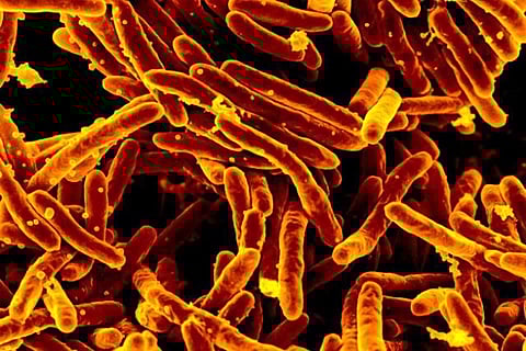 Mycobacterium abscessus