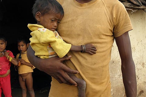 कोविड-19 महामारी के चलते हर रोज 153 बच्चों की जान ले सकता है कुपोषण