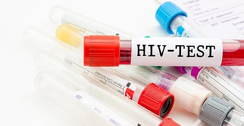 African countries differ widely in prenatal HIV testing: why it matters