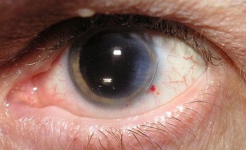 Photo: Wikimedia Commons