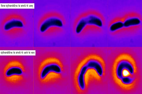 एंटीबायोटिक के संपर्क में आने पर जीवाणु कॉलोबैक्टर क्रेसेंटस की वृद्धि; फोटो: कार्नेगी मेलन यूनिवर्सिटी
