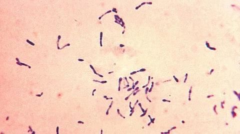 Diphtheria is primarily caused by the bacterium Corynebacterium diphtheriae and is mainly spread by coughs and sneezes, or through close contact with someone infected. Photo: Wikimedia Commons