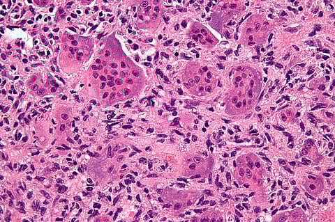 Scientists identify vulnerabilities in over 700 cancer cells that could fuel new treatments