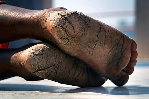भीषण गर्मी और ठंड से हर साल मरते हैं 50 लाख से ज्यादा लोग
