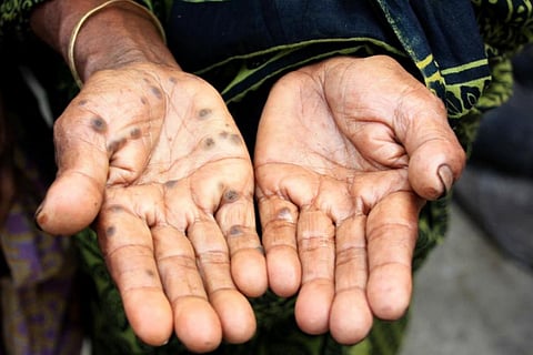 भारतीय वैज्ञानिक ने बनाया ऐसा सेंसर, 15 मिनट में भोजन तथा पानी में मौजूद आर्सेनिक का लगा सकता है पता