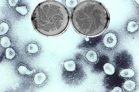 फोटो : क्वींसलैंड विश्वविद्यालय