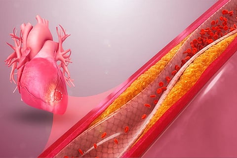 फोटो : विकिमीडिया कॉमन्स