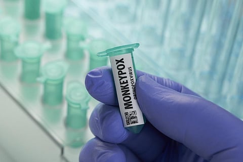 Monkeypox outbreak brings focus back on smallpox vaccines. But which countries have stock?