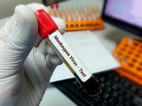 Monkeypox virus found in semen. Is it enough to call it STI?