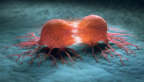 Drug cures rectal cancer patients in new trial. Will this impact current course of treatment?