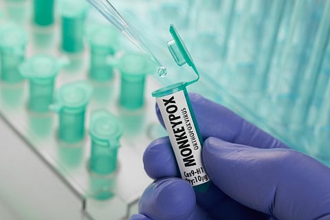 Monkeypox cases in non-endemic countries cross 1,000 mark in a month. What this means