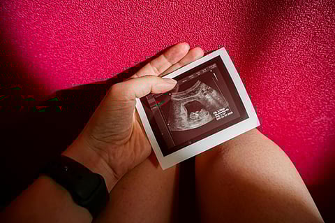 Photo: Shutterstock