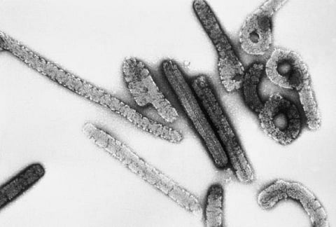 Ghana reports first-ever suspected cases of Marburg virus disease