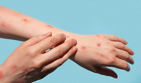 Representative photo from iStock
